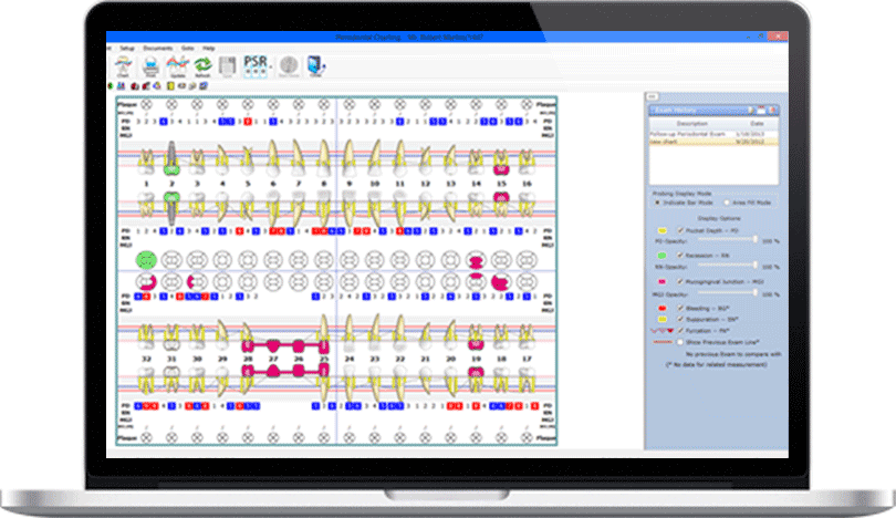 Dental Practice Management Software periodontal charting feature