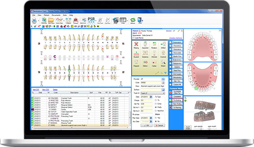 Periodontal Charting Software